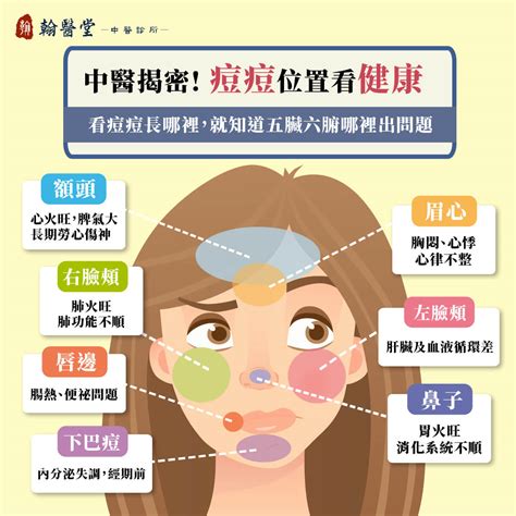 痘痘位置|額頭、下巴狂長痘痘？痘痘位置反映的健康問題與保養對策